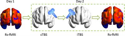 Intermittent Theta-Burst Stimulation Reverses the After-Effects of Contralateral Virtual Lesion on the Suprahyoid Muscle Cortex: Evidence From Dynamic Functional Connectivity Analysis